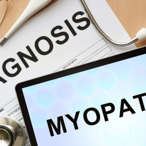 myopathy is an incurable muscle disease that should be treated by a neurologist