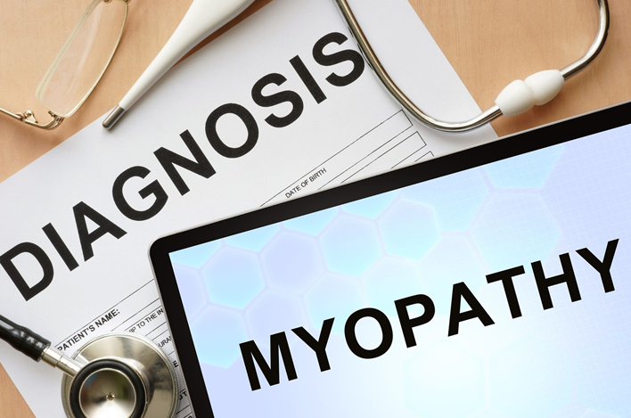 myopathy sign